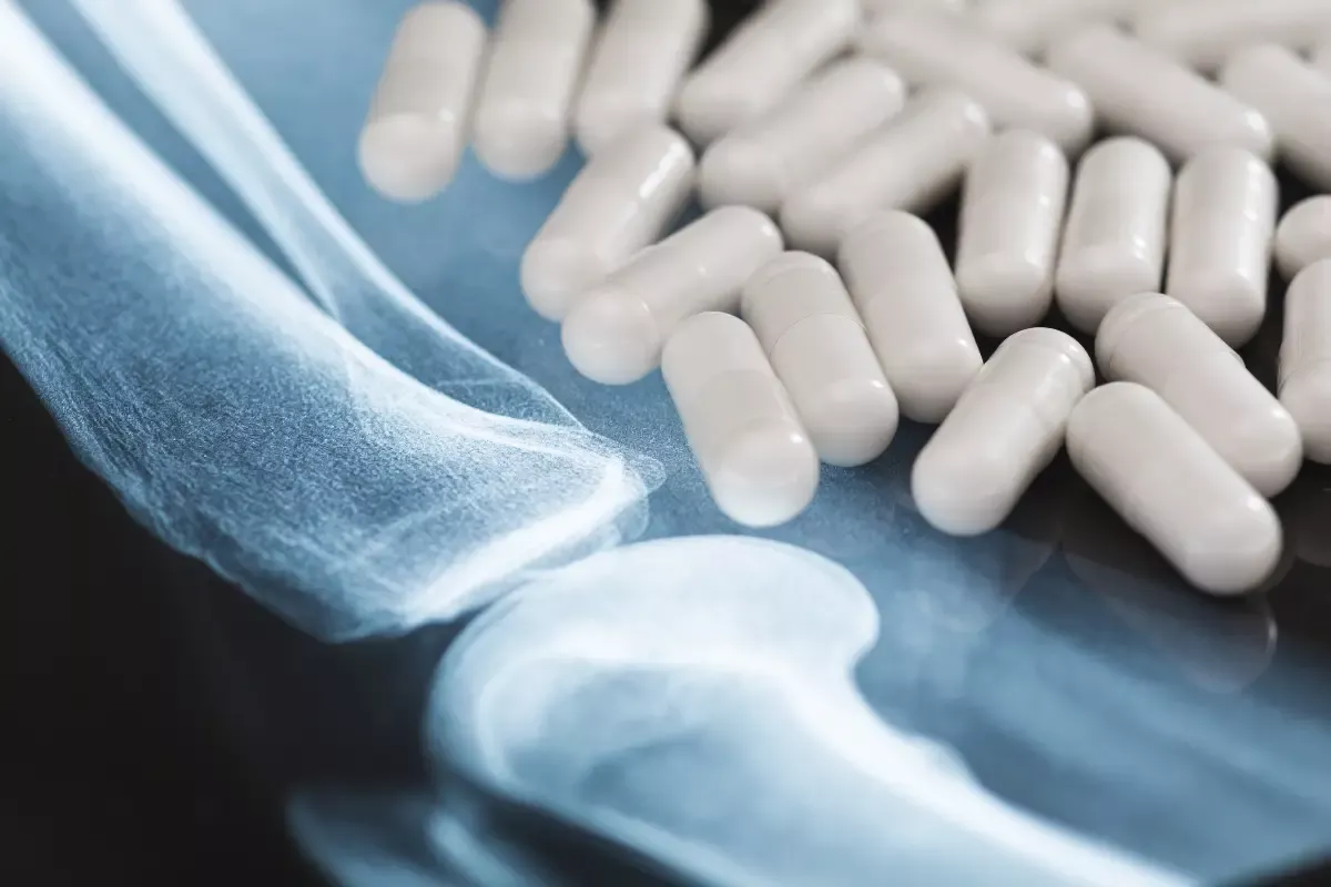 glucosamine et articulation